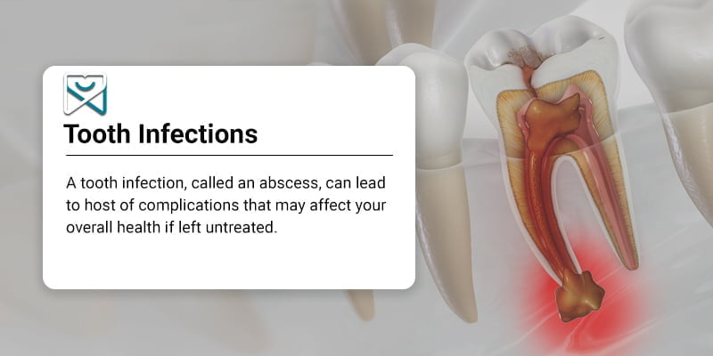 Tooth Infection Treatment Shalman Dentistry In Lower Manhattan NY